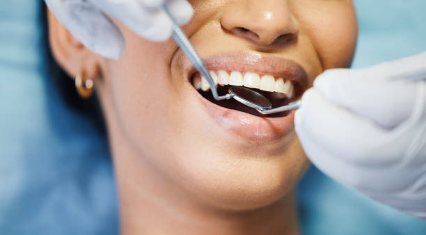 Best Emergency Dental Extractions in Smithers, WV
